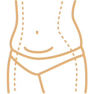 Abdominoplasty